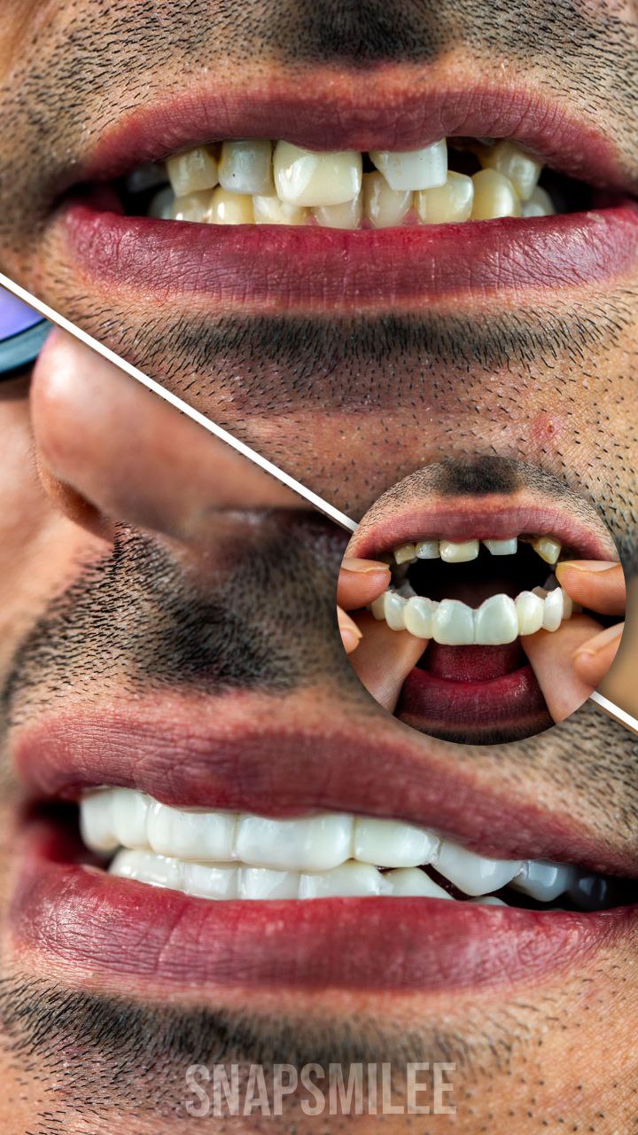 اسنپ اسمایل رنگ سفید تایوانی با جایزه ویژه 200 تومانی